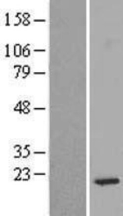 Novus Biologicals&trade;&nbsp;RPS14 Overexpression Lysate