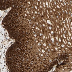 RPS14 Antibody, Novus Biologicals:Antibodies:Primary Antibodies