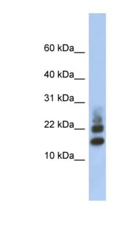 RPS15A Antibody, Novus Biologicals 100&mu;L; Unlabeled:Antibodies, Polyclonal