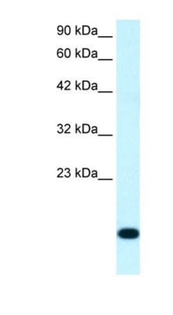 RPS16 Antibody, Novus Biologicals 0.1mg; Unlabeled:Antibodies, Polyclonal