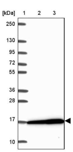RPS16 Antibody, Novus Biologicals:Antibodies:Primary Antibodies