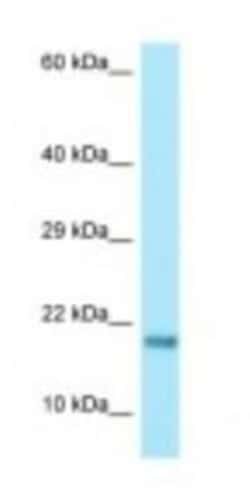 RPS17 Antibody, Novus Biologicals 100 &mu;L | Buy Online | Novus Biologicals | Fisher Scientific