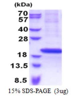Novus Biologicals&trade;&nbsp;Recombinant Human RPS18 His Protein