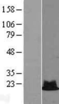 Novus Biologicals™ RPS19 Overexpression Lysate