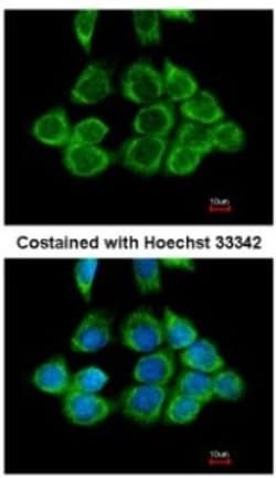 RPS2 Antibody, Novus Biologicals 0.1mL; Unlabeled:Antibodies, Polyclonal