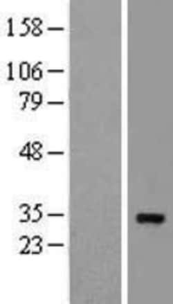 Novus Biologicals&trade;&nbsp;RPS2 Overexpression Lysate
