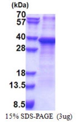 Novus Biologicals Recombinant Human RPS2 His Protein 0.1 mg | Buy Online | Novus Biologicals&trade; | Fisher Scientific