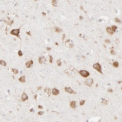 RPS21 Antibody, Novus Biologicals:Antibodies:Primary Antibodies