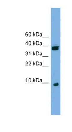 RPS21 Antibody, Novus Biologicals 100 &mu;L | Buy Online | Novus Biologicals | Fisher Scientific