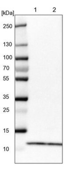 RPS21 Antibody, Novus Biologicals:Antibodies:Primary Antibodies
