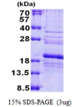 Novus Biologicals&trade;&nbsp;Recombinant Human RPS24 His Protein