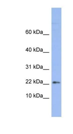 RPS24 Antibody, Novus Biologicals 100&mu;L; Unlabeled:Antibodies, Polyclonal