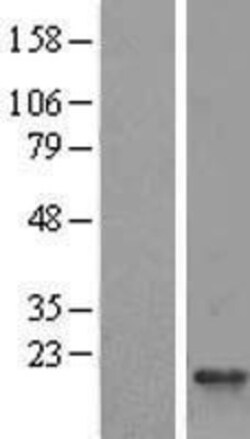 Novus Biologicals&trade;&nbsp;RPS25 Overexpression Lysate