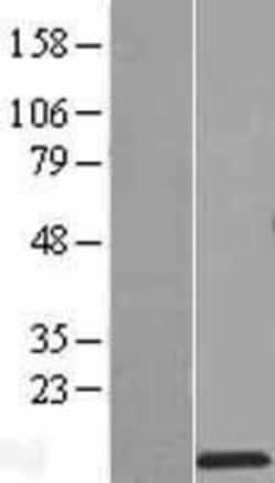 Novus Biologicals&trade;&nbsp;RPS27L Overexpression Lysate
