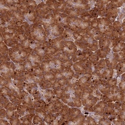 RPS28 Antibody, Novus Biologicals 25 &mu;L | Buy Online | Novus Biologicals | Fisher Scientific