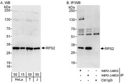 RPS2 Antibody, Novus Biologicals 0.1mg; Unlabeled:Antibodies, Polyclonal