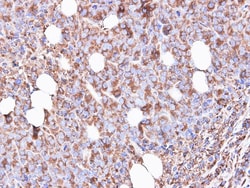 RPS3 Antibody, Novus Biologicals 0.1mg; Unlabeled:Antibodies, Polyclonal