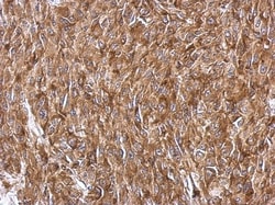 RPS3A Antibody, Novus Biologicals 0.1mL; Unlabeled:Antibodies, Polyclonal