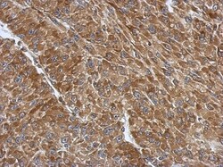 RPS3A Antibody, Novus Biologicals 0.1mL; Unlabeled:Antibodies, Polyclonal