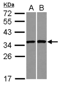 RPS3A Antibody, Novus Biologicals 0.1mL; Unlabeled:Antibodies, Polyclonal