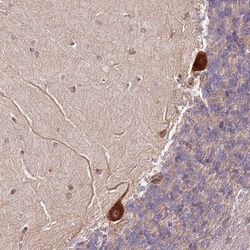 RPS3A Antibody, Novus Biologicals:Antibodies:Primary Antibodies