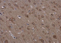 RPS3 Antibody, Novus Biologicals 0.1mg; Unlabeled:Antibodies, Polyclonal