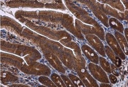 RPS3 Antibody, Novus Biologicals 0.1mg; Unlabeled:Antibodies, Polyclonal