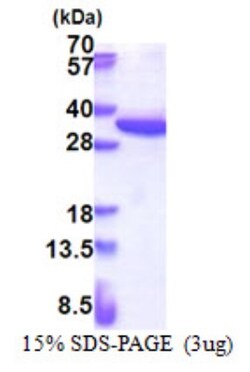 Novus Biologicals&trade;&nbsp;Recombinant Human RPS4X His Protein