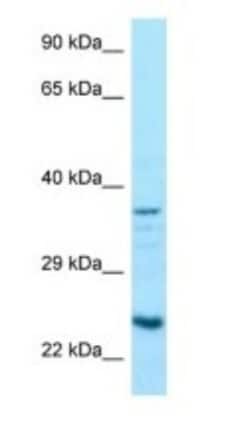 RPS5 Antibody, Novus Biologicals 100&mu;L; Unlabeled:Antibodies, Polyclonal