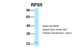 RPS5 Antibody, Novus Biologicals 100&mu;L; Unlabeled:Antibodies, Polyclonal