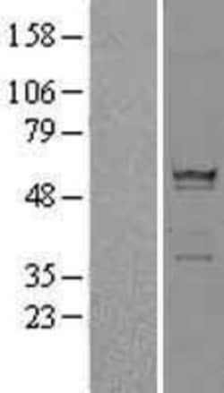 Novus Biologicals&trade;&nbsp;RPS6KL1 Overexpression Lysate