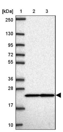 RPS7 Antibody, Novus Biologicals 0.1mL; Unlabeled:Antibodies, Polyclonal