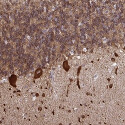 RPS7 Antibody, Novus Biologicals 0.1mL; Unlabeled:Antibodies, Polyclonal