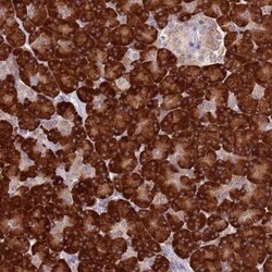 RPS9 Antibody, Novus Biologicals:Antibodies:Primary Antibodies
