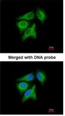 p40 Antibody, Novus Biologicals 0.1mg; Unlabeled:Antibodies, Polyclonal