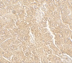 RPSA Antibody - BSA Free, Novus Biologicals 0.1mg; Unlabeled:Antibodies,