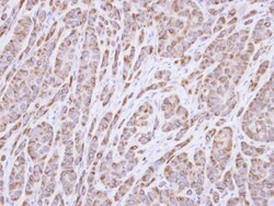 p40 Antibody, Novus Biologicals 0.1mg; Unlabeled:Antibodies, Polyclonal