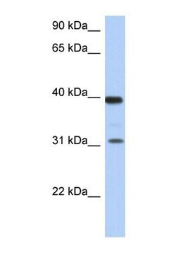 RPSA Antibody, Novus Biologicals 0.05mg; Unlabeled:Antibodies, Polyclonal