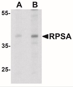 RPSA Antibody - BSA Free, Novus Biologicals 0.1mg; Unlabeled:Antibodies,