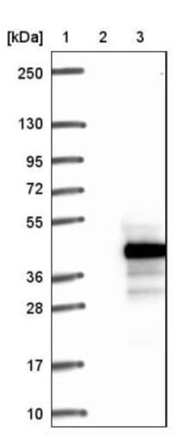 RPUSD1 Antibody, Novus Biologicals 25 &mu;L | Buy Online | Novus Biologicals | Fisher Scientific