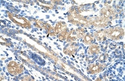 RPUSD2 Antibody, Novus Biologicals 100&mu;L; Unlabeled:Antibodies, Polyclonal