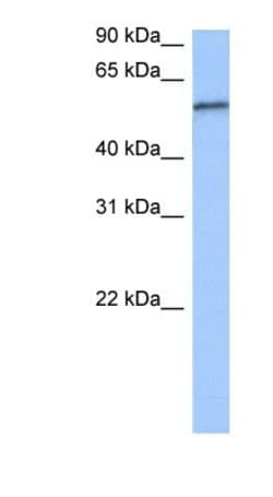 RPUSD2 Antibody, Novus Biologicals 100&mu;L; Unlabeled:Antibodies, Polyclonal