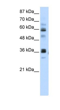 RPUSD2 Antibody, Novus Biologicals 100&mu;L; Unlabeled:Antibodies, Polyclonal