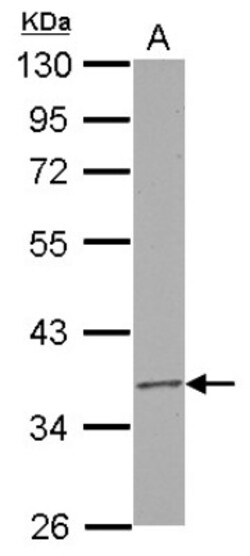 RPUSD3 Antibody, Novus Biologicals 0.1mL; Unlabeled:Antibodies, Polyclonal