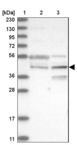 RPUSD3 Antibody, Novus Biologicals 25ul | Buy Online | Novus Biologicals | Fisher Scientific