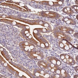 RQCD1 Antibody, Novus Biologicals 0.1mL; Unlabeled:Antibodies, Polyclonal