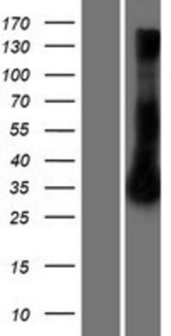 Novus Biologicals&trade;&nbsp;RRAD Overexpression Lysate