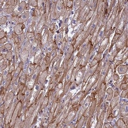 RRAD Antibody, Novus Biologicals 0.1mL; Unlabeled:Antibodies, Polyclonal