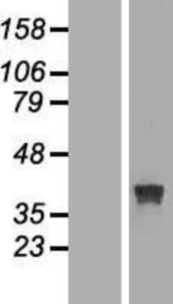 Novus Biologicals&trade;&nbsp;RRAGB Overexpression Lysate