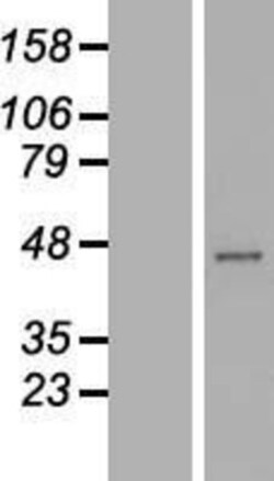 Novus Biologicals&trade;&nbsp;RRAGC Overexpression Lysate